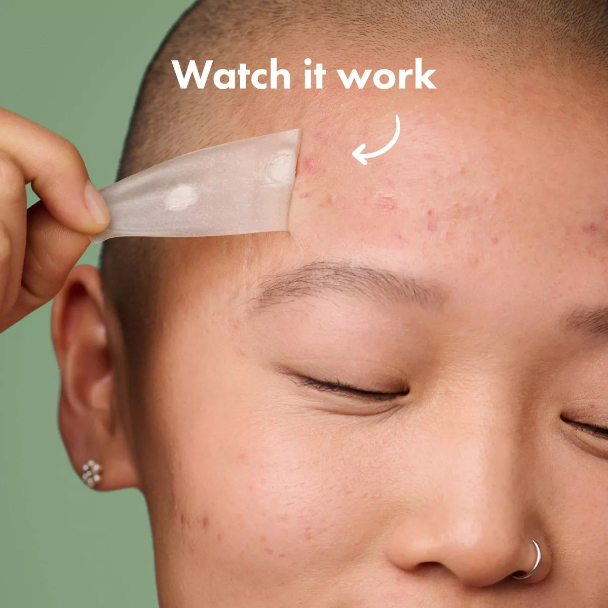 Hero Mighty Patch Surface - 10Ct