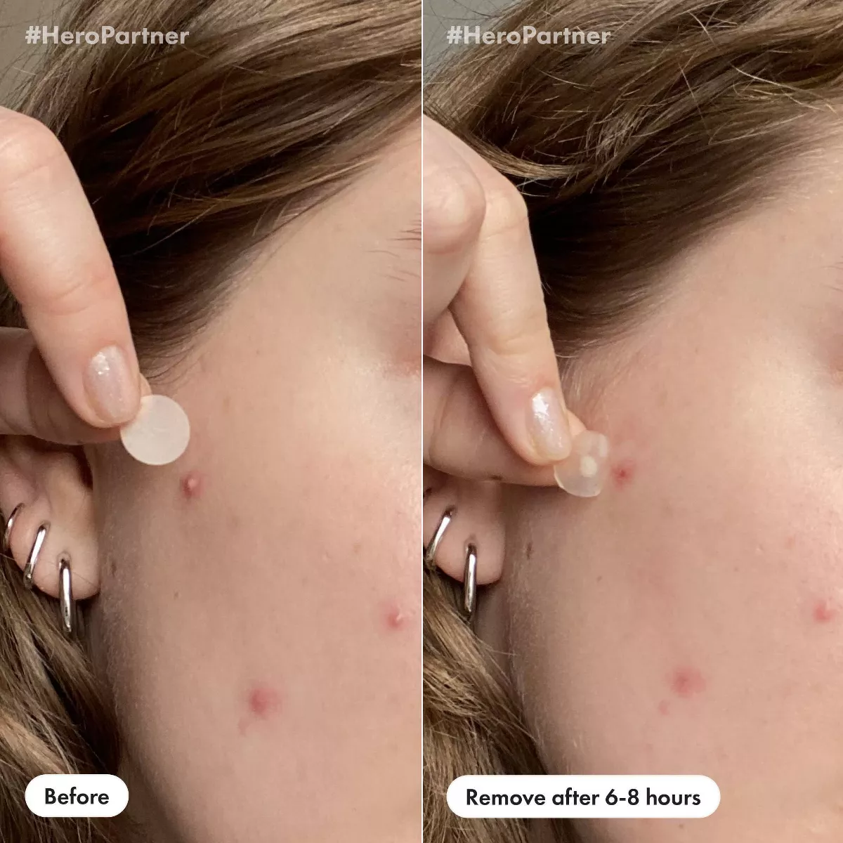 Hero Cosmetics Mighty Patch Day & Night - 36Ct