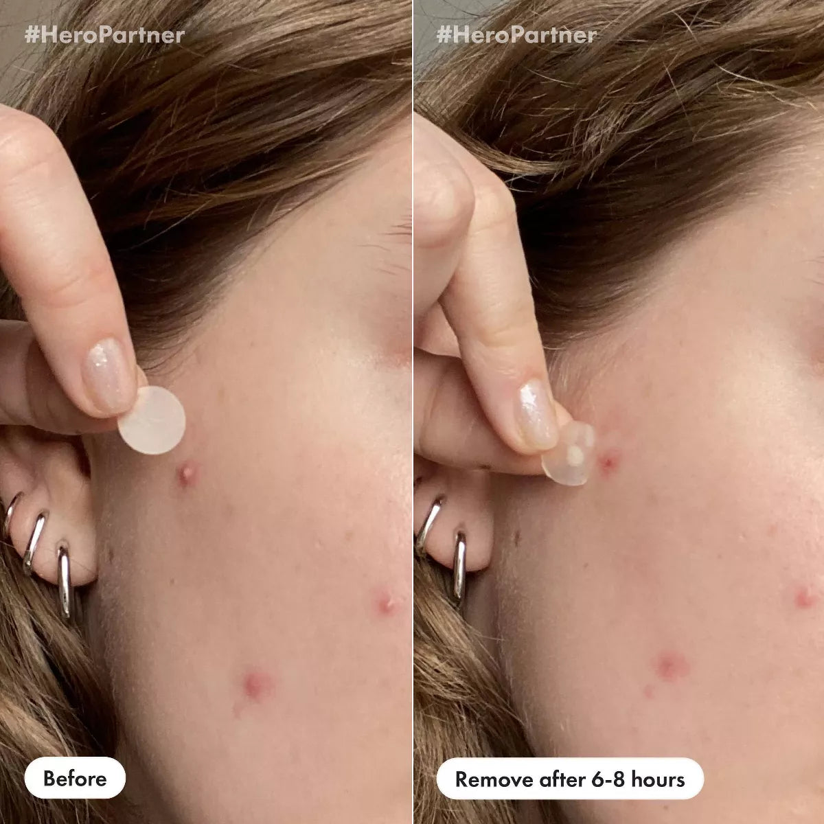 Hero Cosmetics Mighty Patch Day & Night - 36Ct