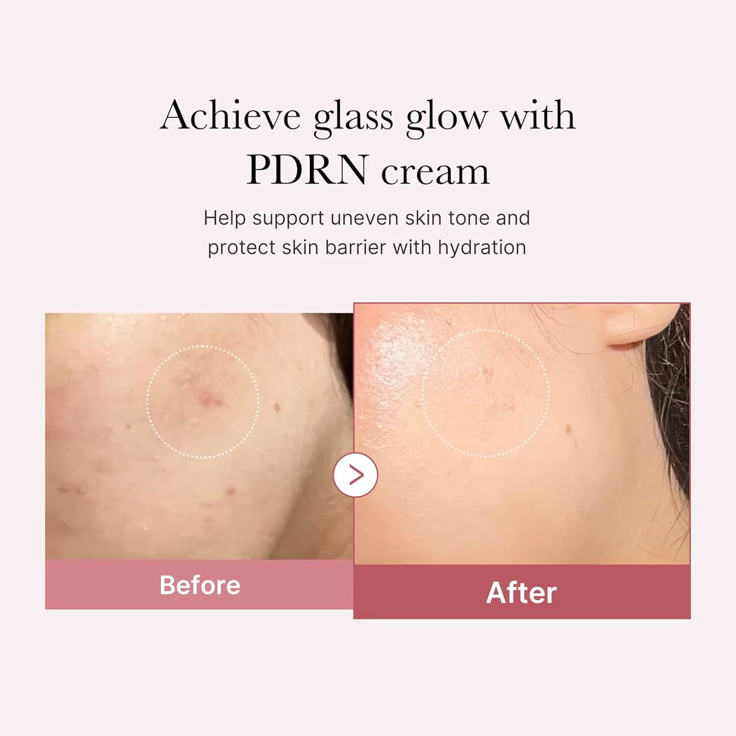 Medicube PD RN Pink Moisturizing Cream Blemish Recovery Relief Hydrating Care Restores Skin Care for Even Skin Tone & Pore Care