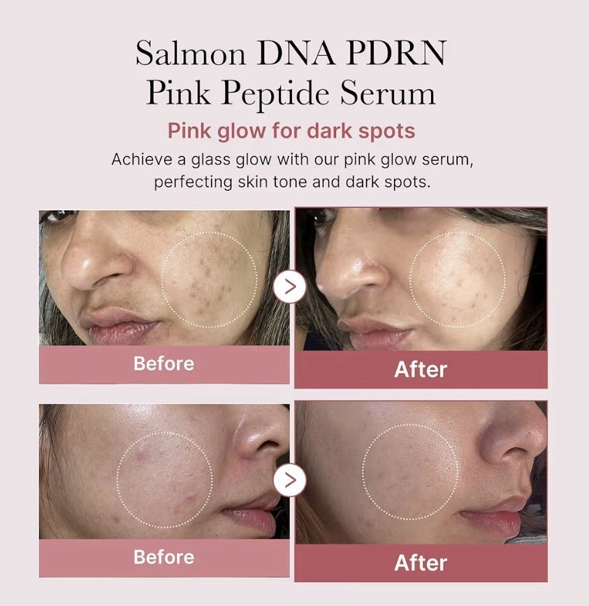 Medicube PDRN Pink Peptide Serum 1.01 Fl Oz– SALMON DNA | Anti-Aging Care