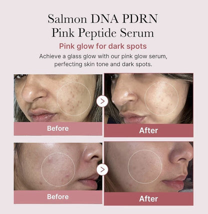 Medicube PDRN Pink Peptide Serum 1.01 Fl Oz– SALMON DNA | Anti-Aging Care